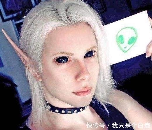 整容|男子为变成精灵王子,削尖耳朵整成怪物,网友:整容前太帅了