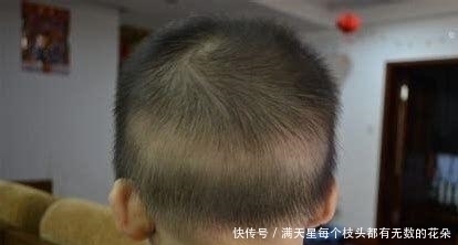 乳牙|怎么知道宝宝缺钙?宝宝缺钙会有这些表现,宝妈发现了吗?