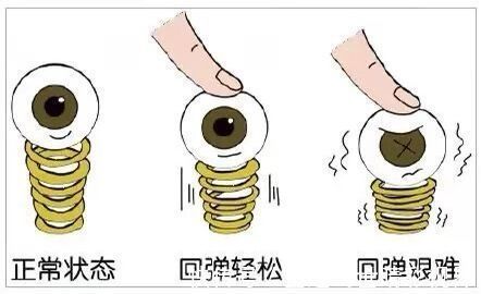 病理性|近视的“生长”史!