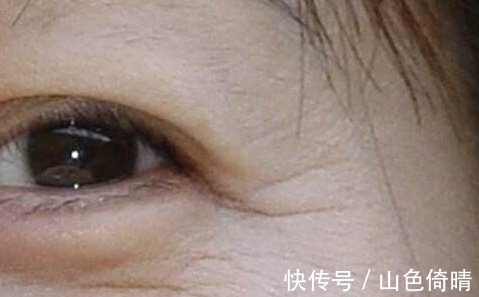 皱纹|别再傻傻的打玻尿酸了,每天用它抹一抹,一周皮肤紧致没皱纹