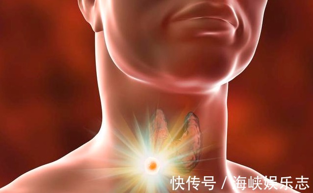 經常生氣易長結節，老中醫一個散結方，化除結節防復發