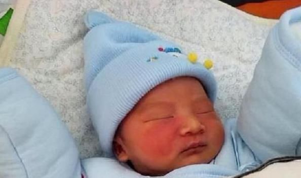 产科医生|胎记是怎么回事产科医生孕期尽量避开3种行为,以免胎儿自卑