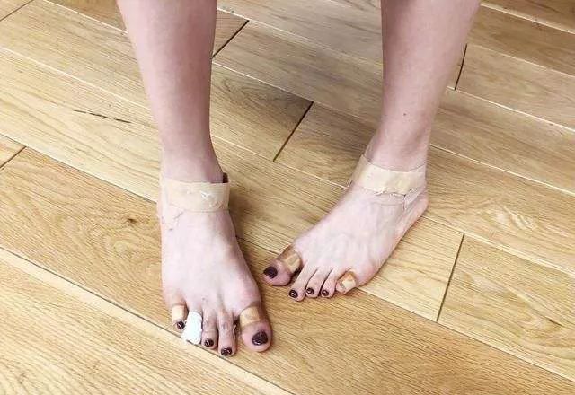 膝关节 它让你美丽十足,也让你伤害万分!高跟鞋的五大伤害你中招几个