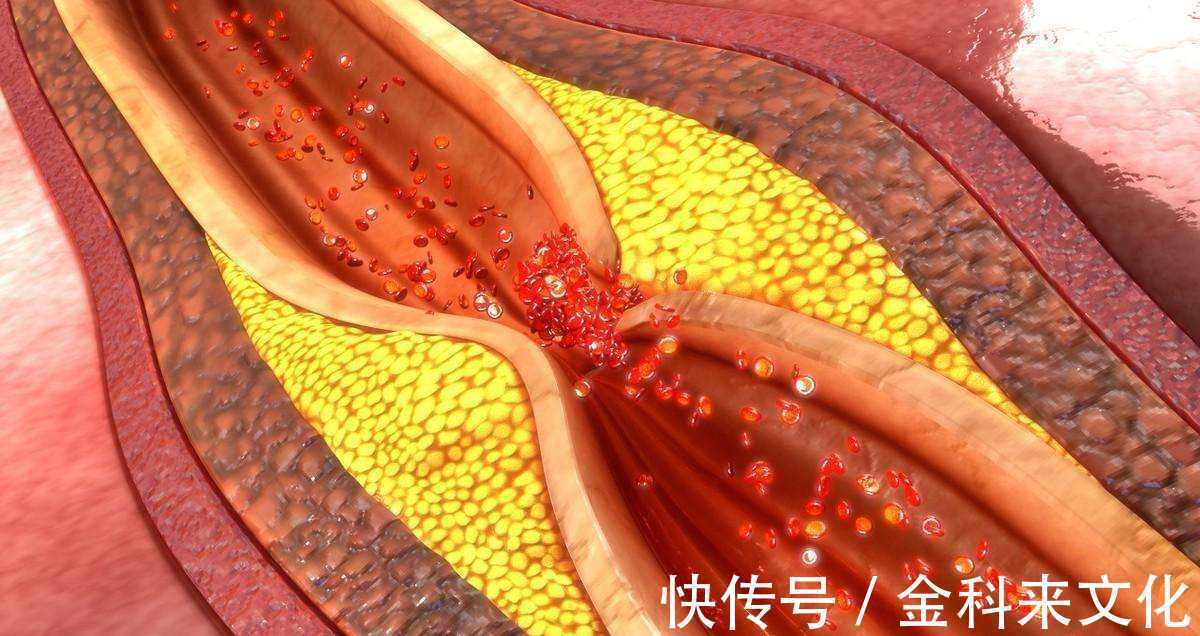 降糖方|得了糖尿病别愁!教你1个“降糖方”,没事喝1杯,血糖“稳稳”的