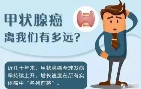 甲状腺结节|为什么甲状腺癌越来越多？如何预防！