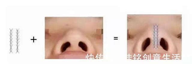 线雕隆鼻 盘点当下“热门医美项目”的几个真相(有些弯路不能走)!