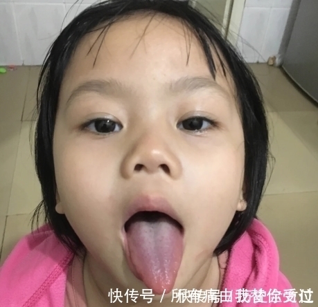 猴菇锌棘|补脾“状元”已找到,平常让孩子敞开吃,积食没了,免疫力也强了