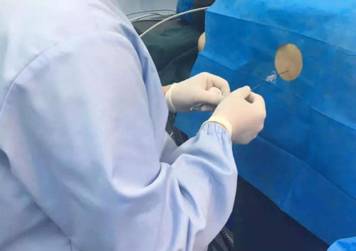 无痛针|“一秒天堂”的无痛分娩,为何很少有孕妈选择?背后原因让人无奈