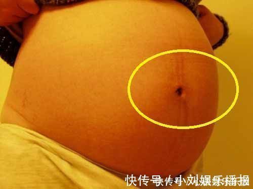怀孕期间|女性怀孕后,肚脐眼是凸起是凹进,受3个因素影响,别轻易忽视