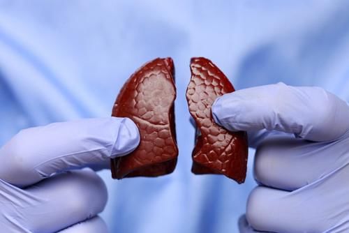 结节|肺结节恶化时 ,检查会有3个“异常”,若没有,恭喜你!肺还算健康