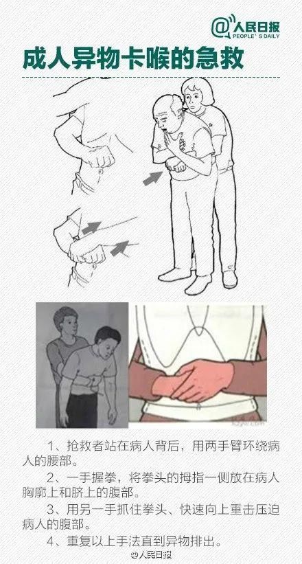 直肠腔|男子长“痔疮”疼痛难忍,万万没想到是它卡在肛门!