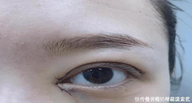 割完“双眼皮”的人,老了之后会变成什么样说出来你可能不信