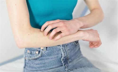 皮肤瘙痒怎么办？这份“止痒攻略”请收好