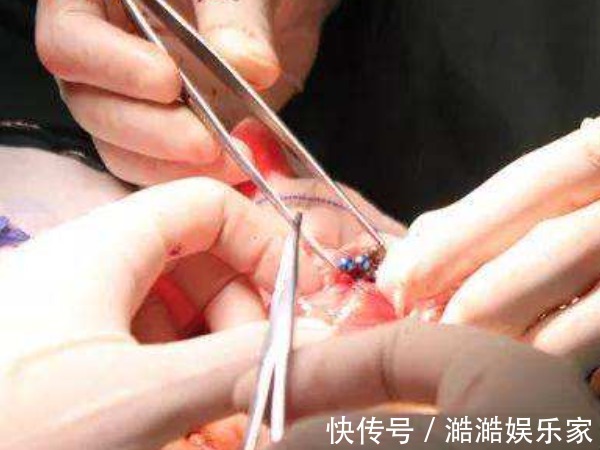 母亲|怀孕后,为何有人一直吐,有人却从不吐医生和腹中胎儿有关