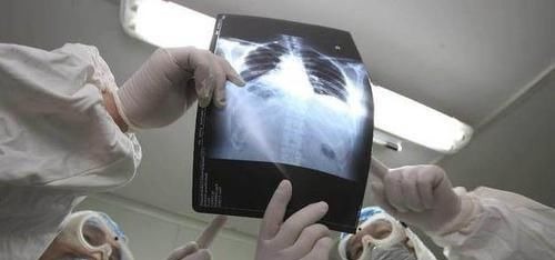 体检|55岁男子，体检正常5个月后查出晚期肺癌去世体检到底有何用