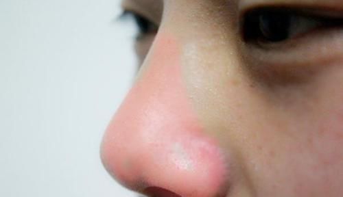 鼻毛太长,冒出鼻孔,要拔掉或剪掉吗为什么鼻毛会冒出鼻孔