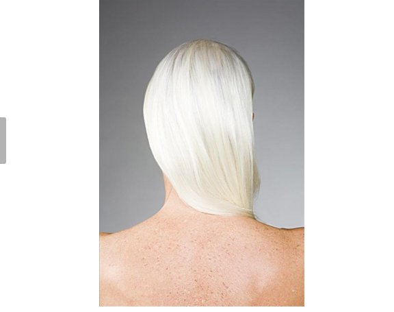 怎样预防控制白发增多