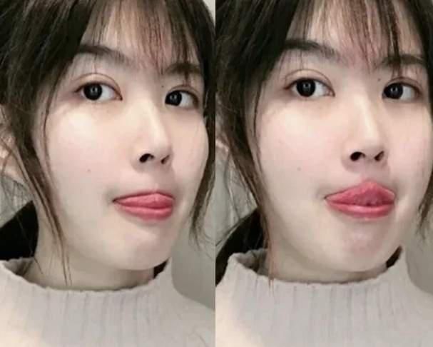 脸胖还有分类型?挑选适合的瘦脸操运动 轻松消除双下巴