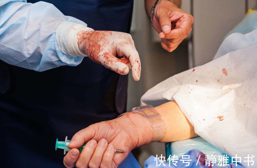 超声检查|很多人不重视脑供血不足，却不知道是脑中风的前奏，如何检查预防