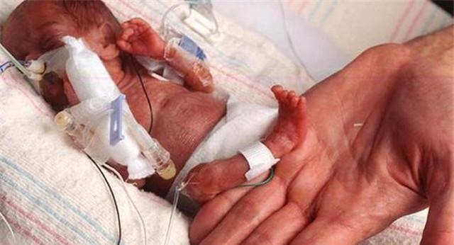 拇指姑娘|童话里的“拇指姑娘”走进现实,一出生仅25厘米,如今美出泡儿