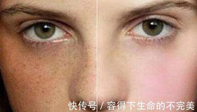 白带|女性有妇科病,身上会有4个表现,若你都没有,恭喜了