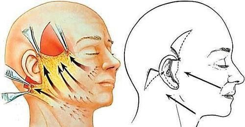 医生|40-50岁想做拉皮手术,医生细说一些真实有用的建议