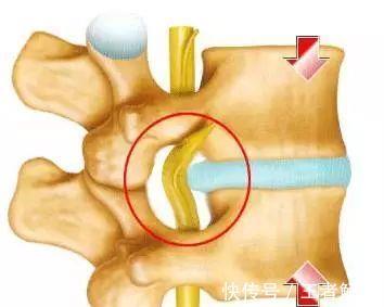 脊髓|什么是颈椎病，对照这些症状，看看你有没有中招