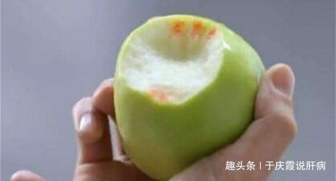 肝硬化|肝不好的人，身体5点异常，是在通知你肝硬化、肝癌悄然而至