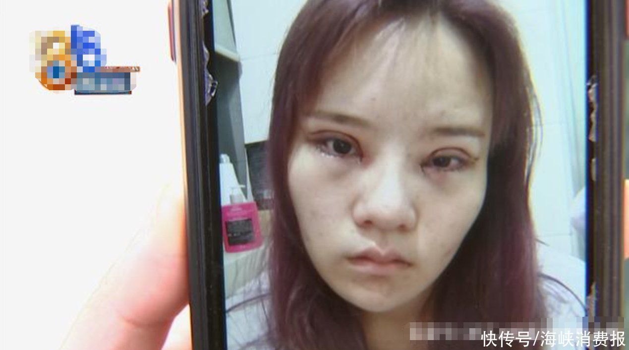 女子|女子花3万多割双眼皮,术后还没以前好看,医生:可以修复