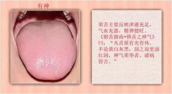 舌诊|中医医生总看舌头都在看什么九种体质+珍贵的舌诊图谱