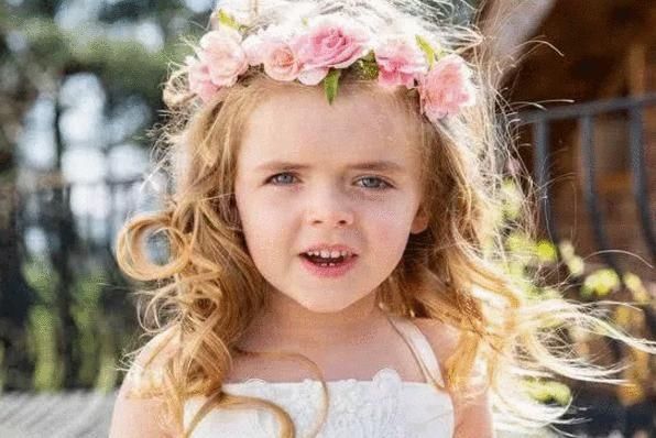 ell女孩生下来就“整容”,被医生打碎骨头重造,如今5岁美出天际