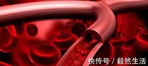 食物|高血脂别急着吃药，常吃这6种食物，血脂慢慢就会降下来！