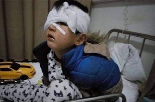 轩轩|30分钟男孩眼珠被“吃光”,罪魁祸首家家都有,家长一定要警惕