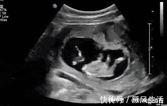 变化孕|怀孕后,不只是肚子会变大,孕妈身体的这些地方,也会有不同变化