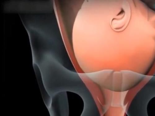 过程|顺产的全过程到底是怎样的,生而为人需了解,请勿泪奔