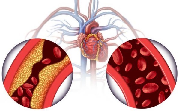 舒张压|高血压压差大是怎么回事如何合理控制本文讲出实情