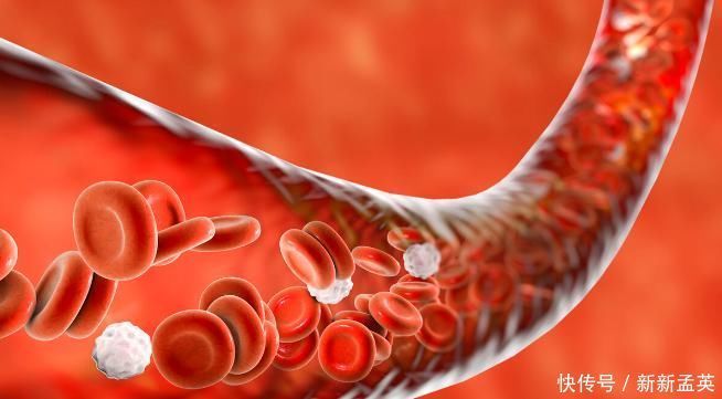 血管堵塞|老年人血管抵抗力下降,不妨做好4件事,让血管恢复弹力,不淤堵