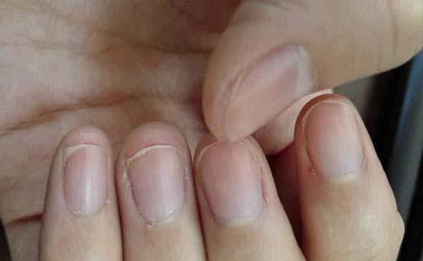 指甲|肝不好，双手会有提示，3个异常表现，伸出双手看看你有没有