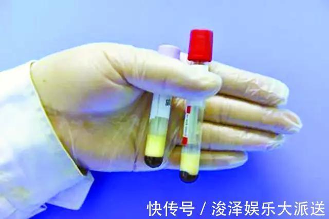 血脂|男子血脂10.8!仅2个月,血脂恢复正常!降血脂冠军是什么