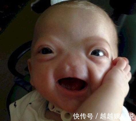 爸爸|小女孩生下来就没有鼻子,爸爸曾想抛弃孩子,妈妈的话让宝爸泪目