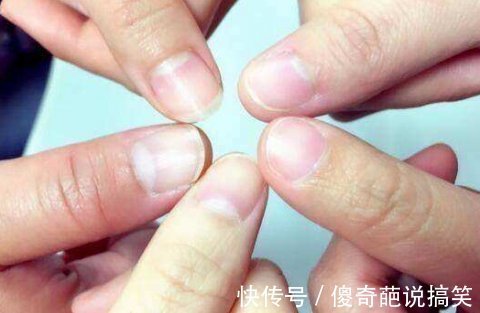 健康|指甲上没有月牙就代表不健康？不完全正确！