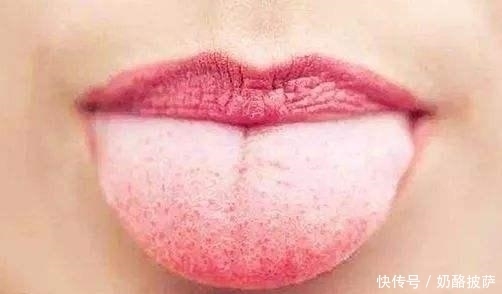  颜色发|提醒：如果你的舌头是3种颜色，要当心，很可能是健康出了问题