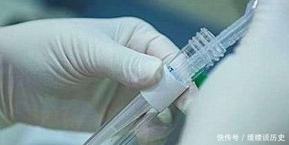 备孕|备孕超过一年没有怀孕,要做什么检查?