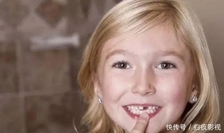 是真的吗|如果用牙齿来判断颜值的话，大家觉得问题容易出现在哪里呢？