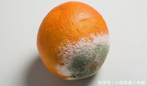 蜘蛛痣|肝变“硬”和吃面条有关?医生坦言:养肝护脏,这2种食物要远离