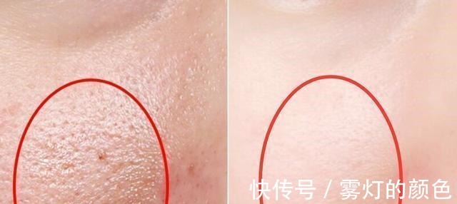 药店|药店有一种乳膏, 皮肤越擦越白, 全是胶原蛋白, 可惜知道的人稀少!