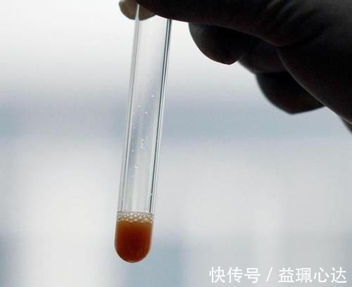 血脂|高血脂人群，尽量少吃这几种食物，或有利于血脂平稳