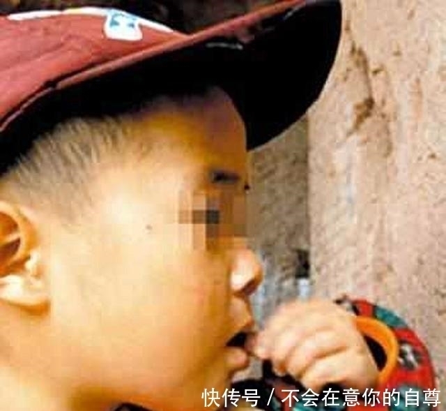 家长|12岁女孩腹痛两年,肚子里出现马蹄形状的团块,都怪家长太粗心