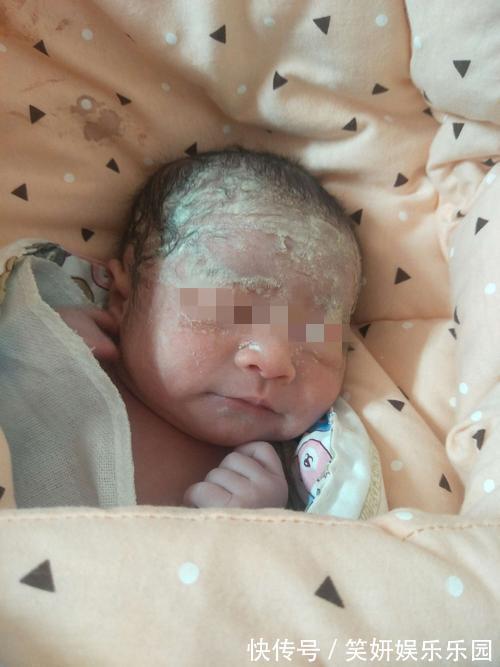 新生儿|新生儿全身包裹“奶油”,陪产爸爸看到后大哭,医生:可喜可贺