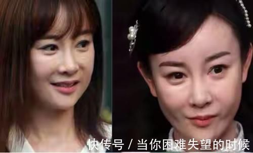 无戏可拍|张檬最后悔的事就是整容！道出整容原因有二，不自信与为爱整容